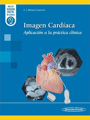 IMAGEN CARDÍACA