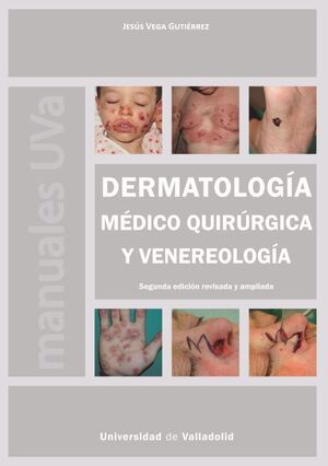 DERMATOLOGÍA MÉDICO QUIRÚRGICA Y VENEREOLOGÍA