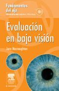 EVALUACIÓN DE BAJA VISIÓN. FUNDAMENTOS DEL OJO