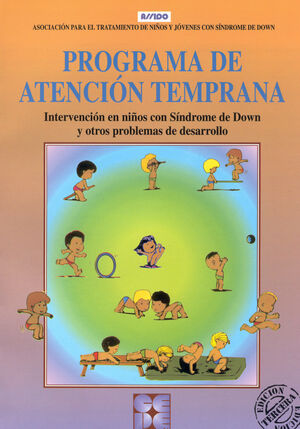 PROGRAMA DE ATENCIÓN TEMPRANA. INTERVENCIÓN EN NIÑOS CON SÍNDROME DE DOWN Y OTRO