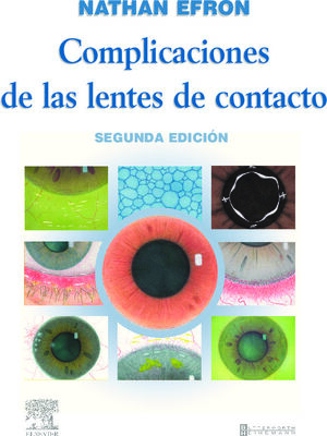 COMPLICACIONES DE LAS LENTES DE CONTACTO. 2ª ED. 2005