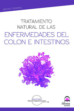 TRATAMIENTO NATURAL DE ENFERMEDADES DEL COLON E INTESTINOS