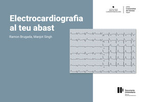 ELECTROCARDIOGRAFIA AL TEU ABAST